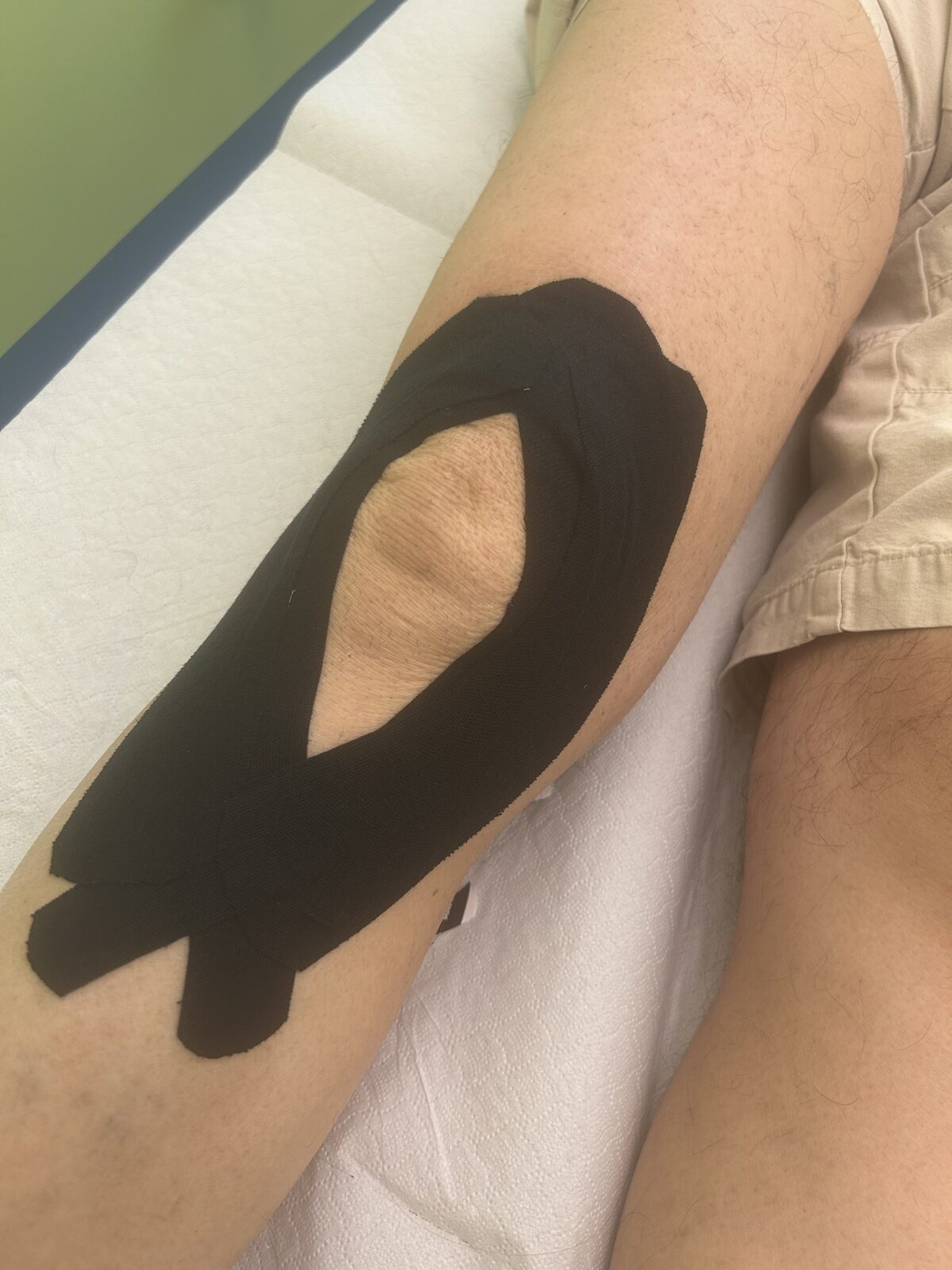 Applicazione di kinesio tape al ginocchio