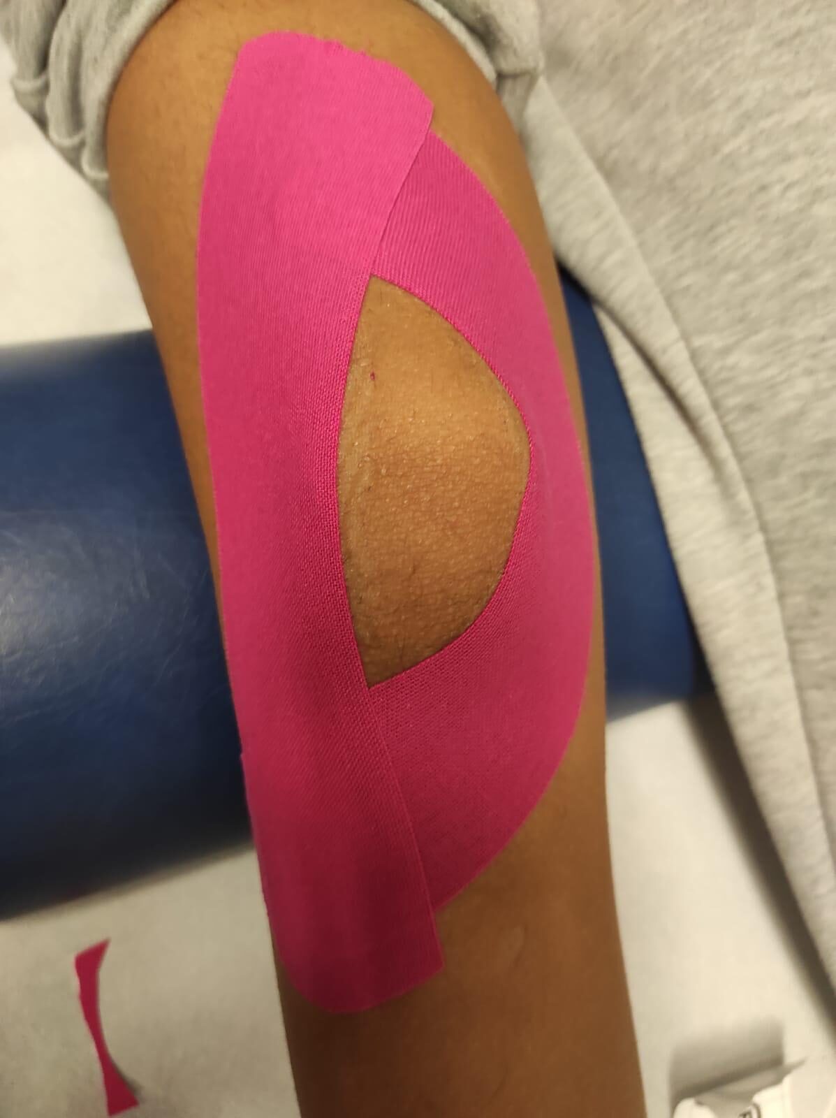 Neurotaping al ginocchio