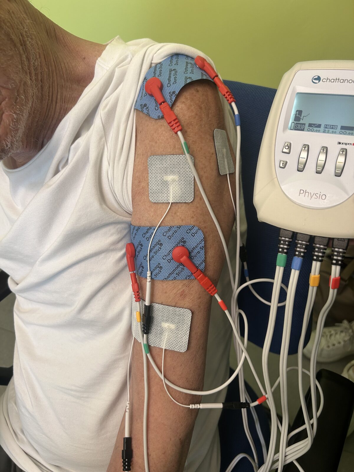 Elettrostimolazione dell'arto inferiore